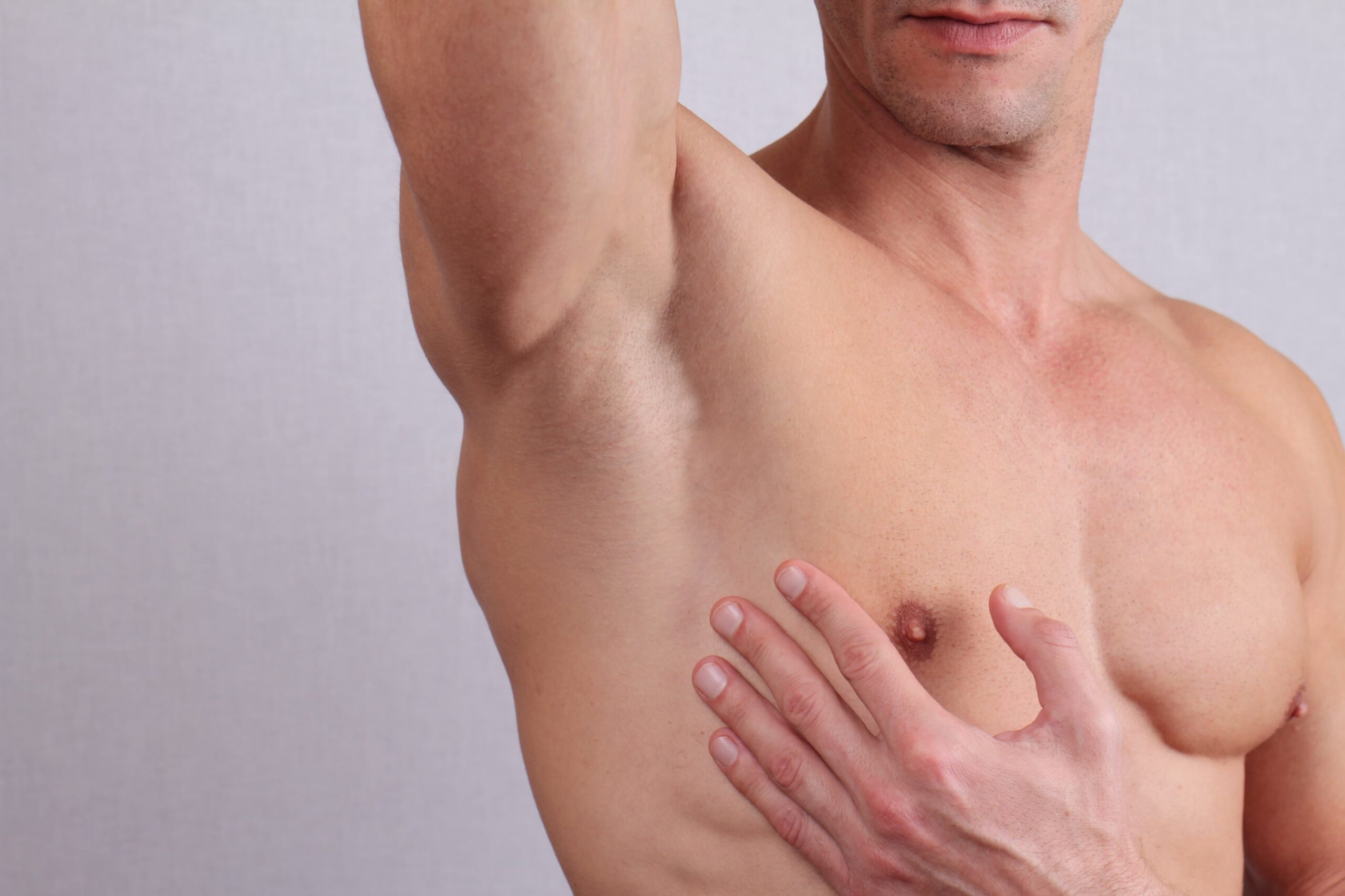 Gynecomastia-min